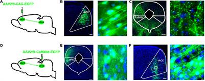 Rostral Anterior Cingulate Cortex–Ventrolateral Periaqueductal Gray Circuit Underlies Electroacupuncture to Alleviate Hyperalgesia but Not Anxiety-Like Behaviors in Mice With Spared Nerve Injury